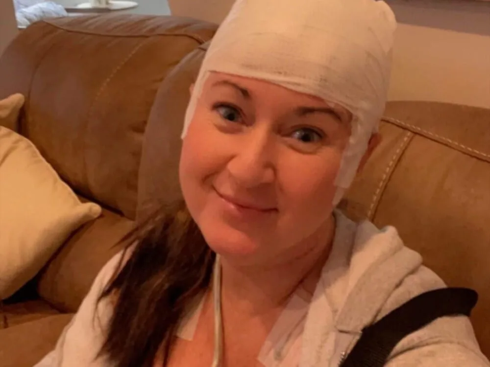 Woman with head wrapped in gauze.